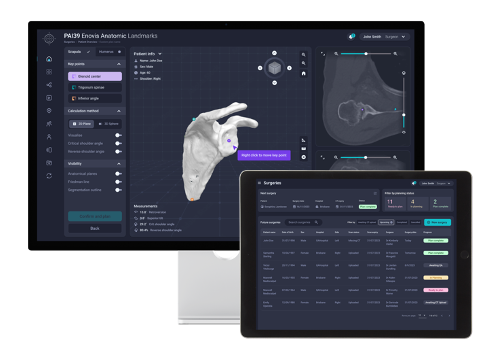 Precision AI System image